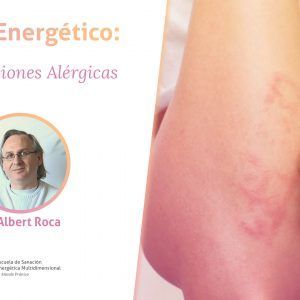 Reaccion Alérgica
